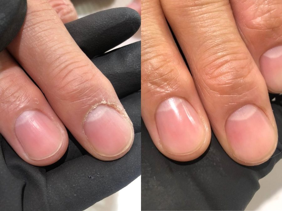 ネイルメンテナンスの施術例 Before/After（神戸・三宮 ネイルサロン アリエ）