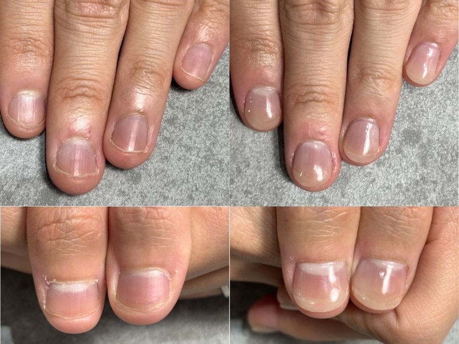 メンズ ハンドの施術例 Before/After（神戸・三宮 ネイルサロン アリエ）