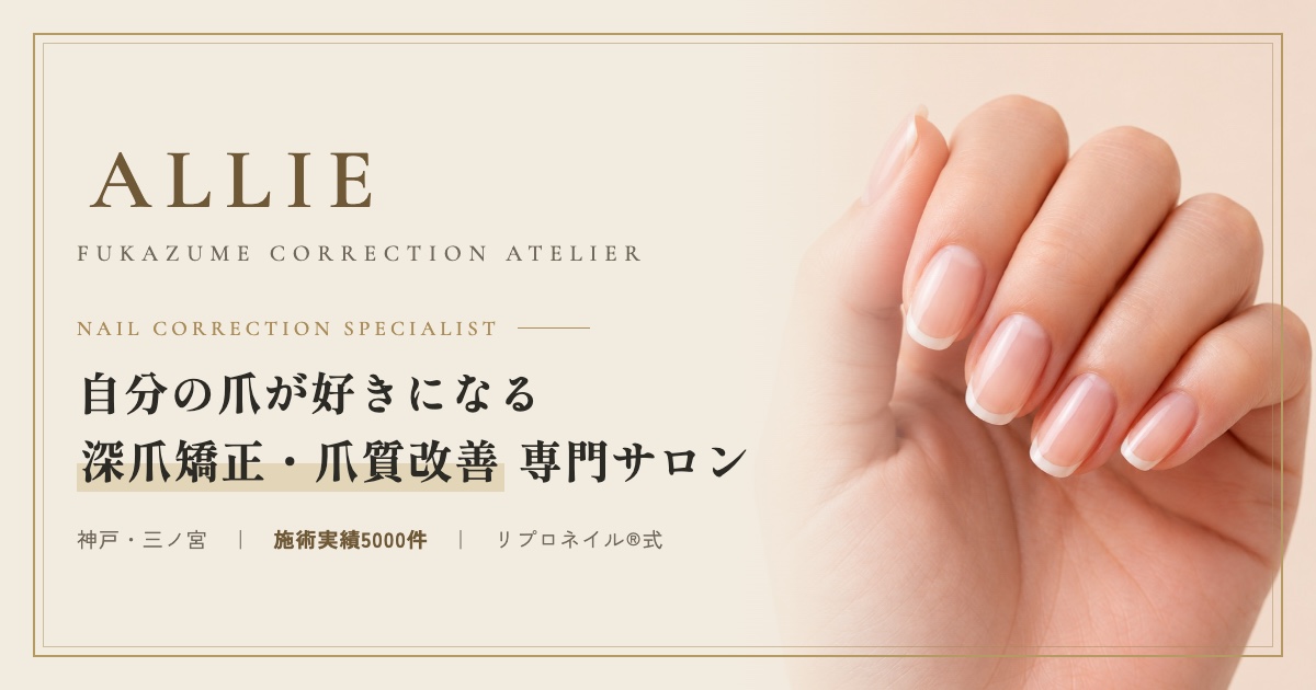 深爪矯正のメニュー・料金の外観